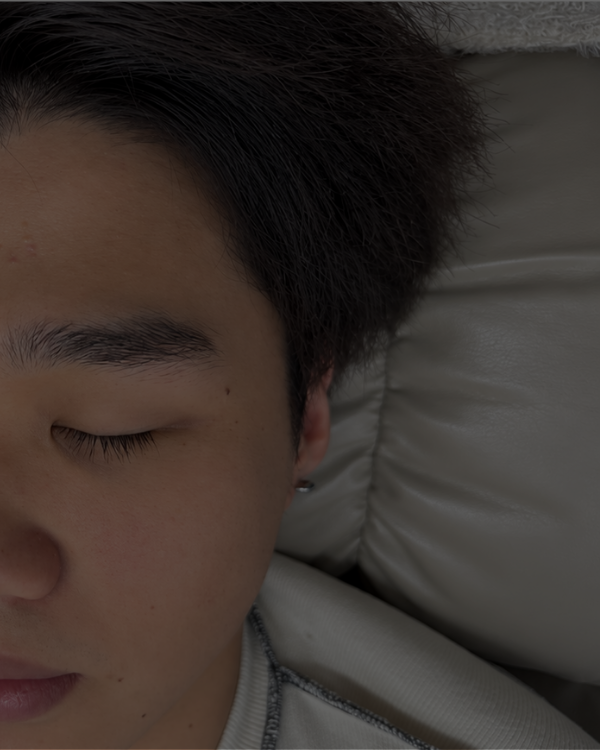 Before